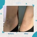 Brighty Glowing Underarm Cream X Glowing Underarm Scrub (Limited Package Brighty) thumbnail 4