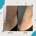 Brighty AHA Hero Exfoliating Liquid X Glowing Underarm Scrub thumbnail 4