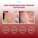 Brighty 20% AHA BHA PHA LHA Peeling Solution Pencerah Kulit Exfoliasi Peeling Serum Pembersih Komedo Serum Komedo Serum Pencerah Serum Pemutih Serum Bekas Jerawat Serum Acne Pelembab Wajah Essence Pencerah Scrub Exfoliasi Sudah BPOM Halal Chemical Peeling thumbnail 8