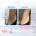 Brighty Multipurpose Exfoliating Toner X Glowing Underarm CreamX Charcoal Underarm Masque thumbnail 5