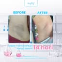(Bundle 2 Pcs) Brighty AHA Hero Exfoliating Liquid Serum thumbnail 7