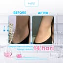 [Bundle Glowing] Brighty Glowing Underarm Cream 2 Pcs thumbnail 7